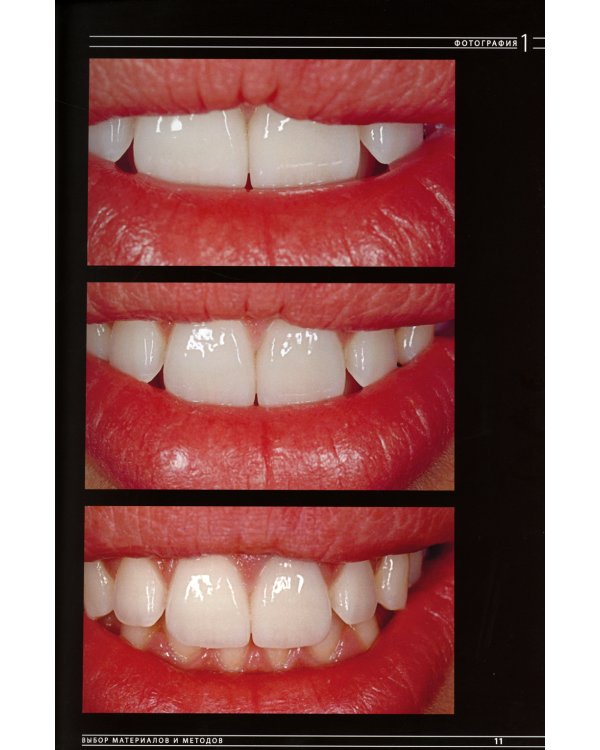 Эстетическая и реставрационная стоматология. Выбор материалов и методов