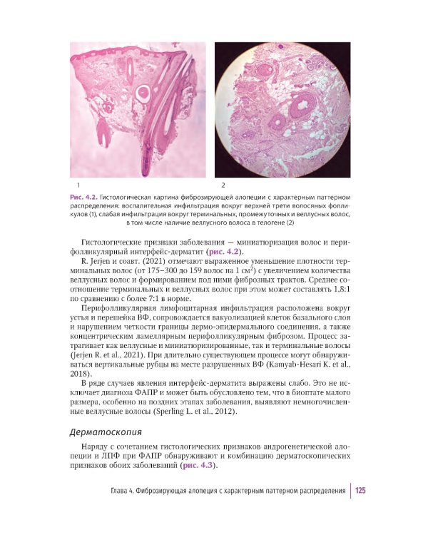 Первичные рубцовые алопеции: диагностика и лечение: иллюстрированное руководство для врачей