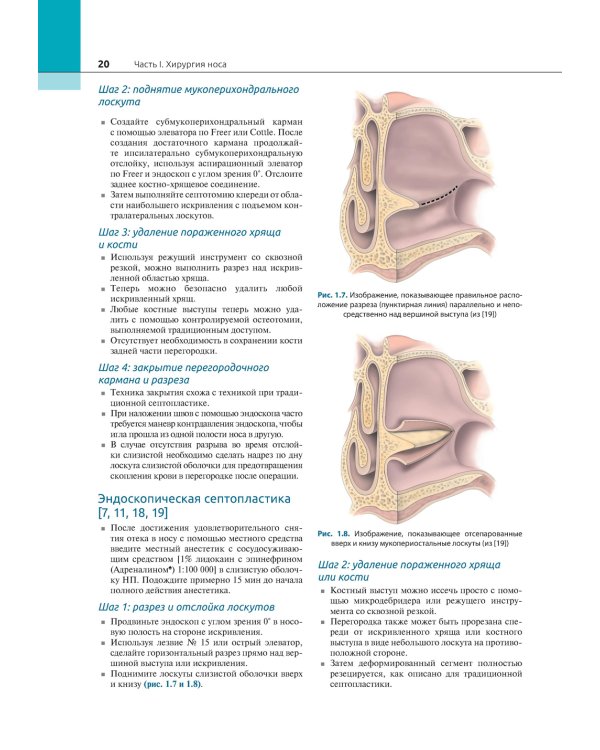 Атлас эндоскопической хирургии околоносовых пазух и основания черепа