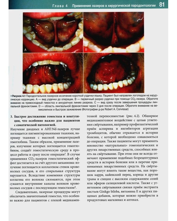 Лазеры в стоматологии. Фундаментальные основы и клиническая практика. 2-е изд