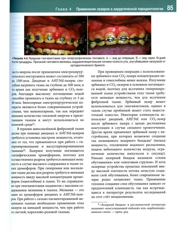 Лазеры в стоматологии. Фундаментальные основы и клиническая практика. 2-е изд