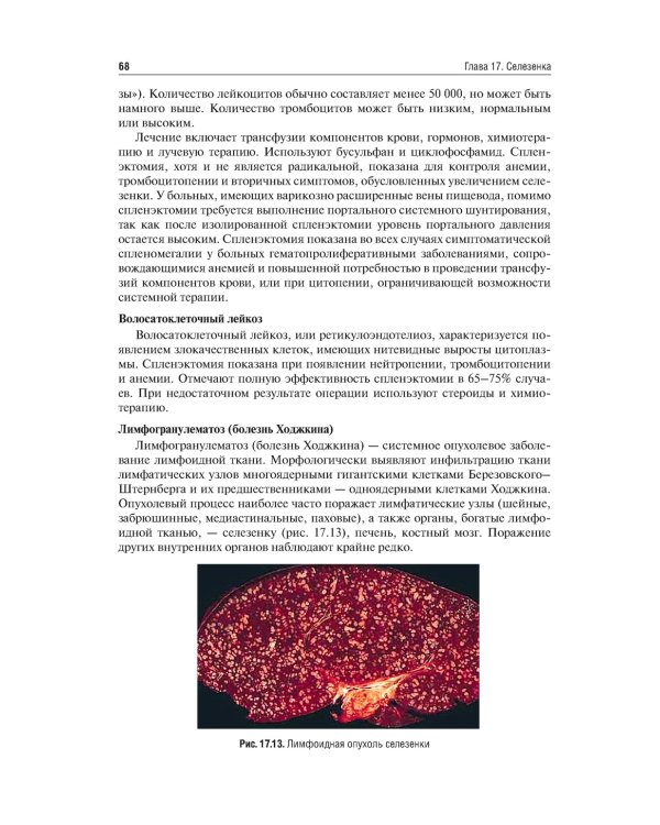 Хирургические болезни: Учебник. В 2 т. Т. 2