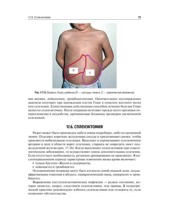 Хирургические болезни: Учебник. В 2 т. Т. 2