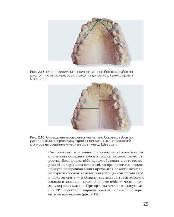 Ортодонтия. Современные методы диагностики аномалий зубов, зубных рядов и окклюзии: Учебное пособие