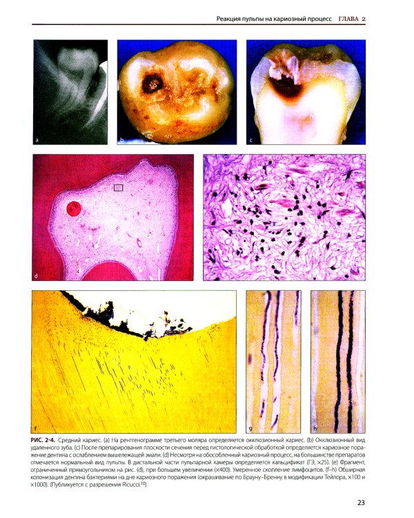 Эндодонтология. Клинико-биологические аспекты