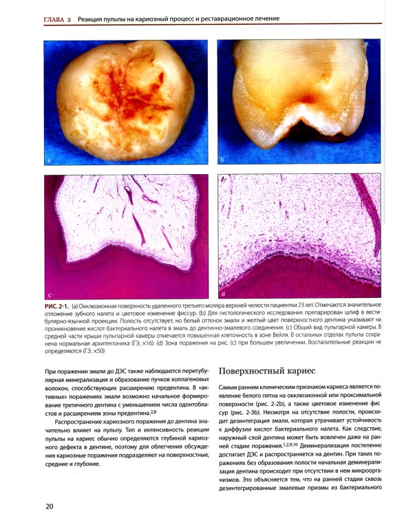 Эндодонтология. Клинико-биологические аспекты
