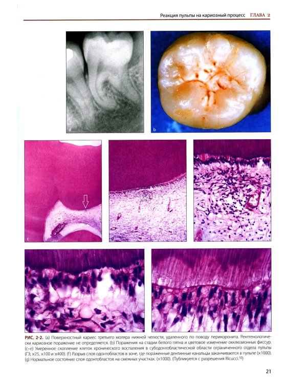 Эндодонтология. Клинико-биологические аспекты