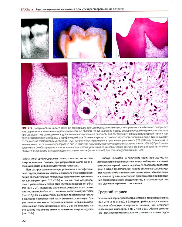 Эндодонтология. Клинико-биологические аспекты