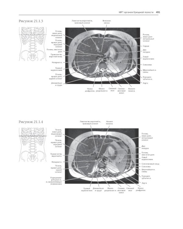 МРТ и КТ. Секционная анатомия