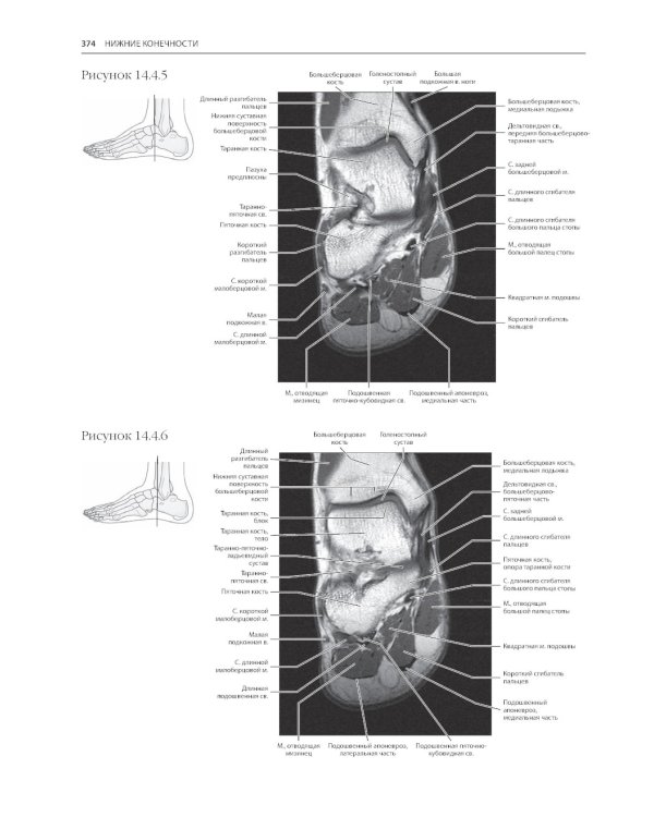 МРТ и КТ. Секционная анатомия