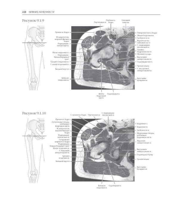 МРТ и КТ. Секционная анатомия