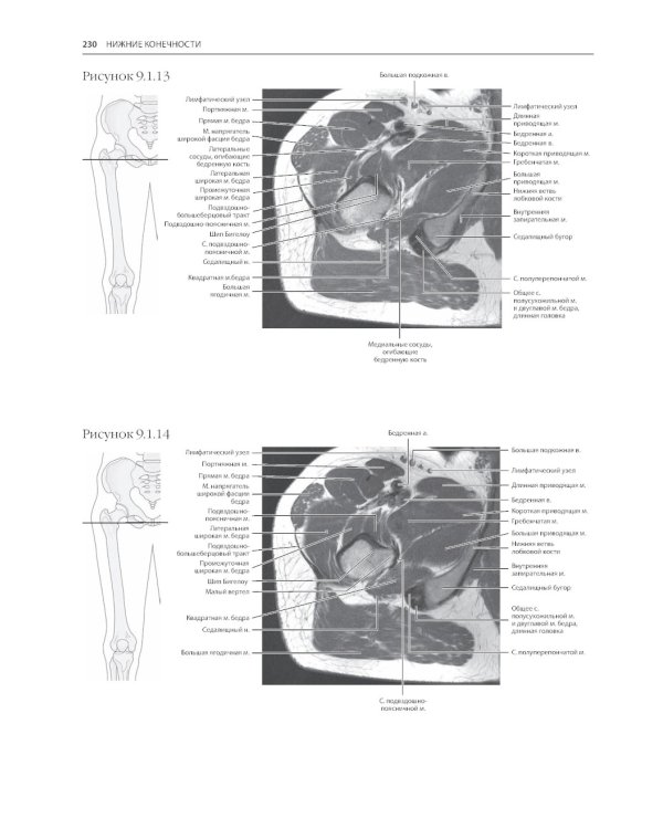 МРТ и КТ. Секционная анатомия