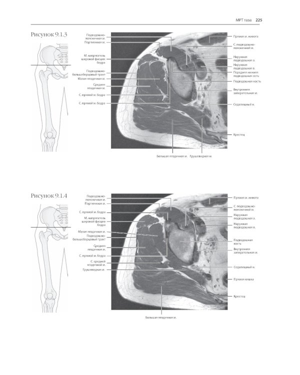 МРТ и КТ. Секционная анатомия