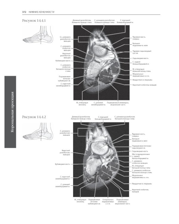 МРТ и КТ. Секционная анатомия