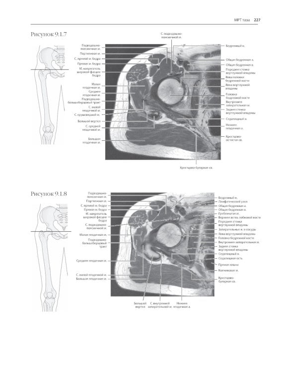 МРТ и КТ. Секционная анатомия