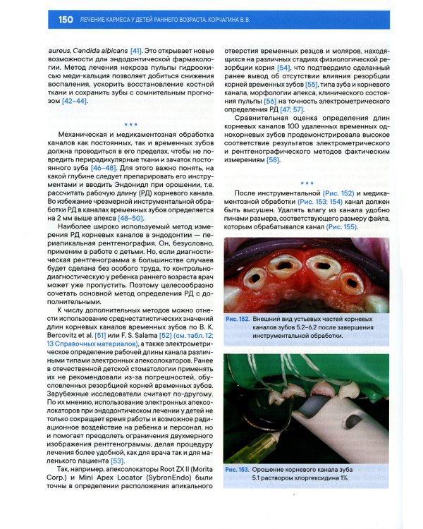 Лечение кариеса у детей раннего возраста