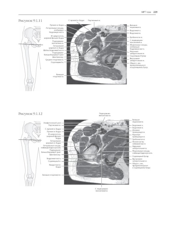 МРТ и КТ. Секционная анатомия