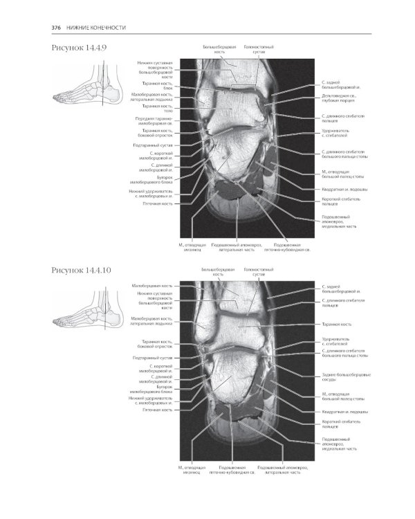 МРТ и КТ. Секционная анатомия