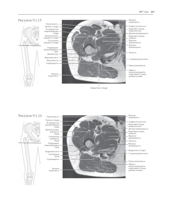МРТ и КТ. Секционная анатомия