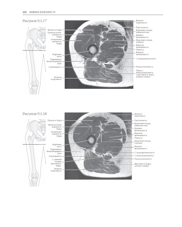 МРТ и КТ. Секционная анатомия