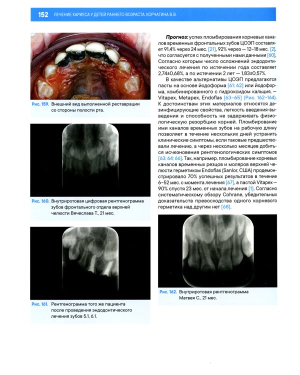 Лечение кариеса у детей раннего возраста