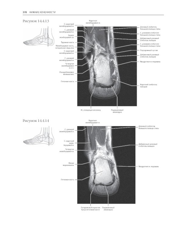 МРТ и КТ. Секционная анатомия