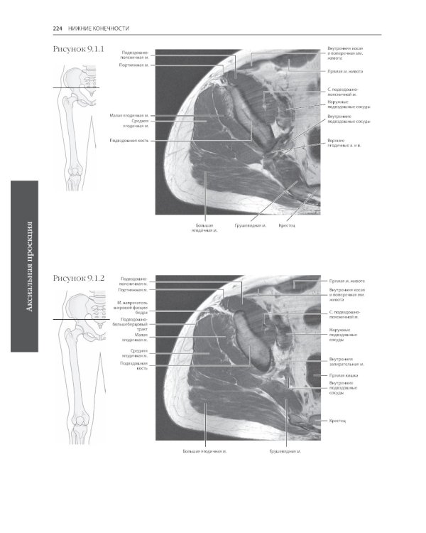 МРТ и КТ. Секционная анатомия
