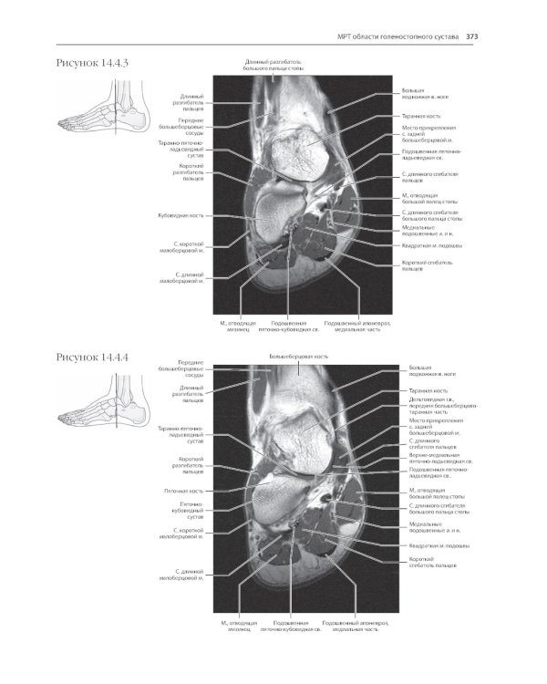 МРТ и КТ. Секционная анатомия