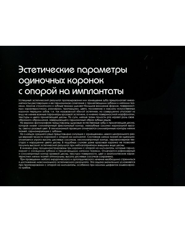 Эволюция. Актуальные протоколы замещения передних зубов с помощью имплантатов