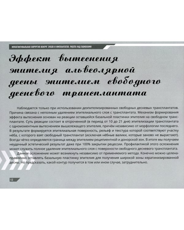 Мукогингивальная хирургия вокруг зубов и имплантатов: работа над ошибками