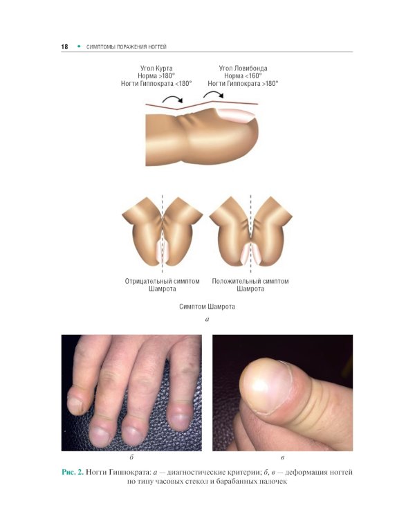 Поражения ногтей в практике врача-дерматовенеролога: руководство для врачей