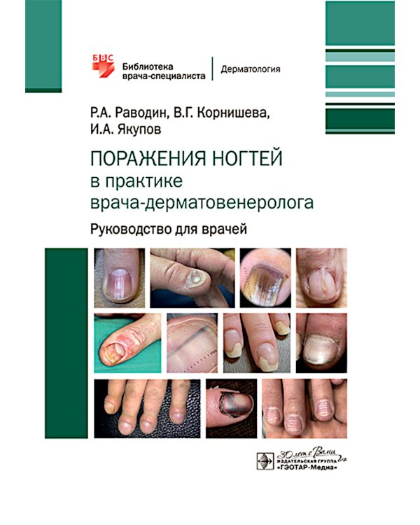 Поражения ногтей в практике врача-дерматовенеролога: руководство для врачей
