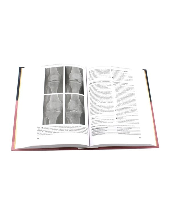 Рациональная фармакотерапия. Справочник терапевта: руководство для практикующих врачей. 2-изд