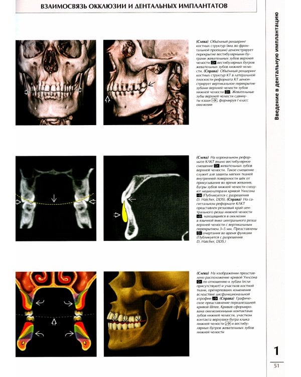 Профессиональная визуализация в дентальной имплантации