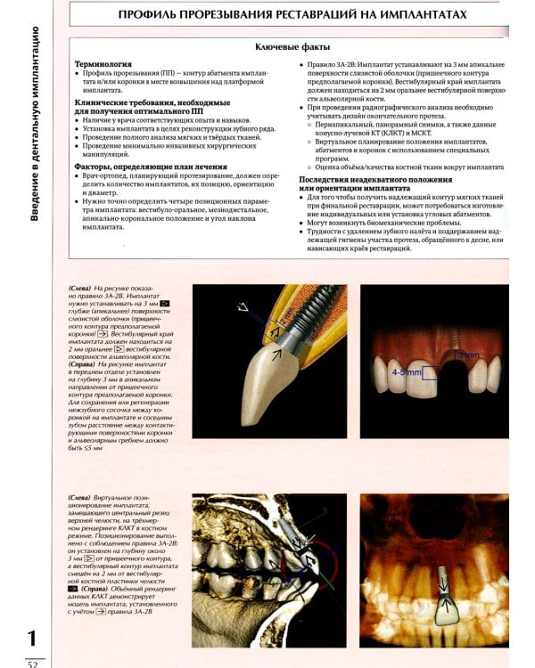 Профессиональная визуализация в дентальной имплантации