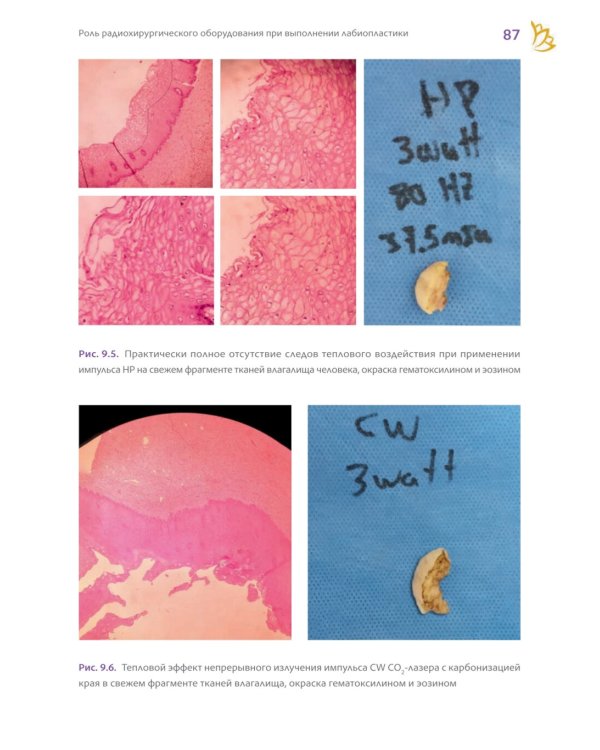 Топографическая лабиопластика. От теории к клинической практике