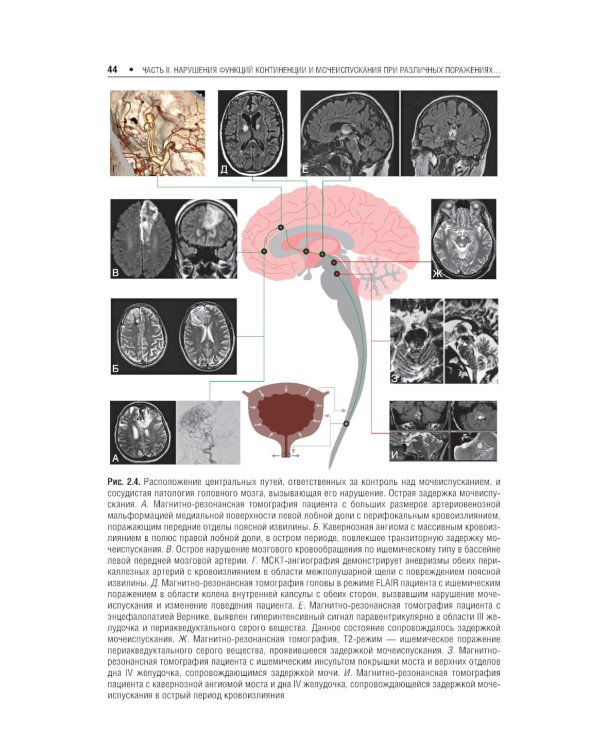 Нейроурология: Учебное пособие. 2-е изд., перераб. и доп