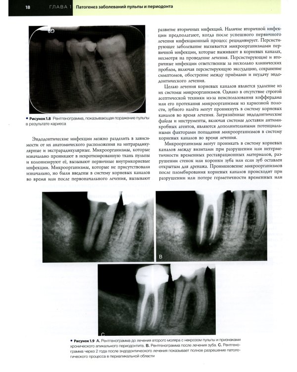 Эндодонтия. Принципы и практика. 6-е изд