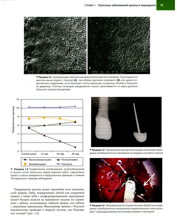 Эндодонтия. Принципы и практика. 6-е изд