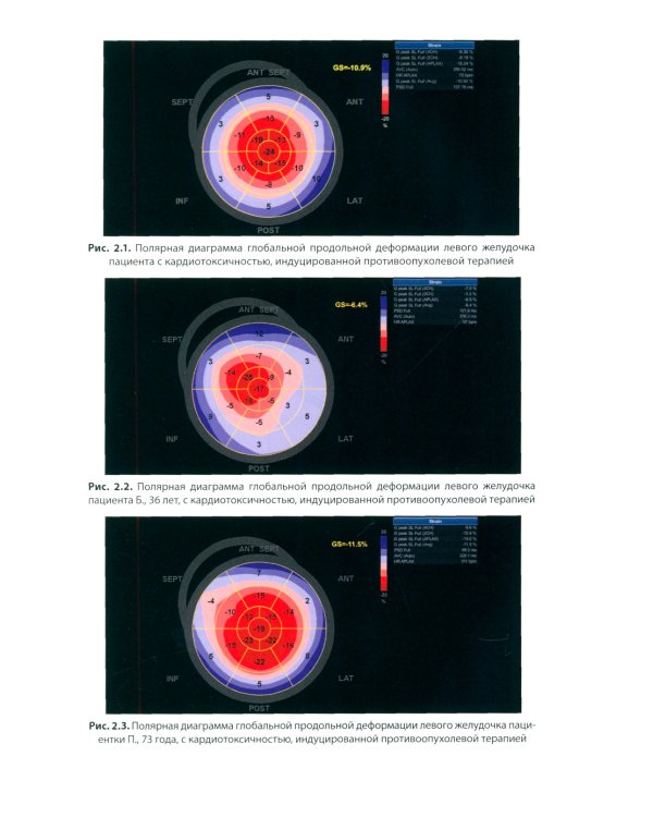 Кардиоонкология: руководство для врачей