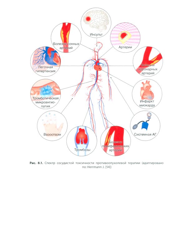 Кардиоонкология: руководство для врачей