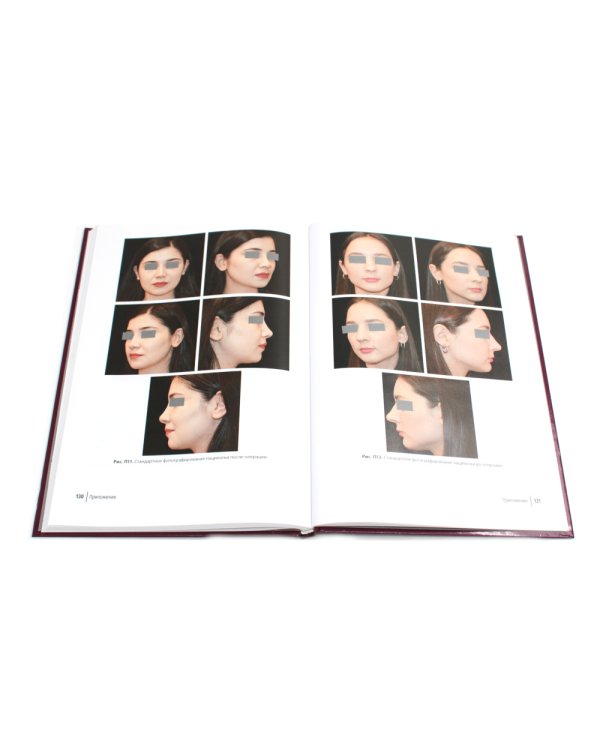 Эстетическая хирургия носа. Красота и здоровье