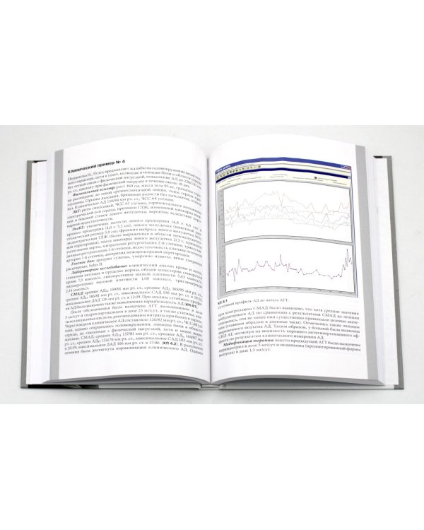 Суточное мониторирование артериального давления: современные аспекты