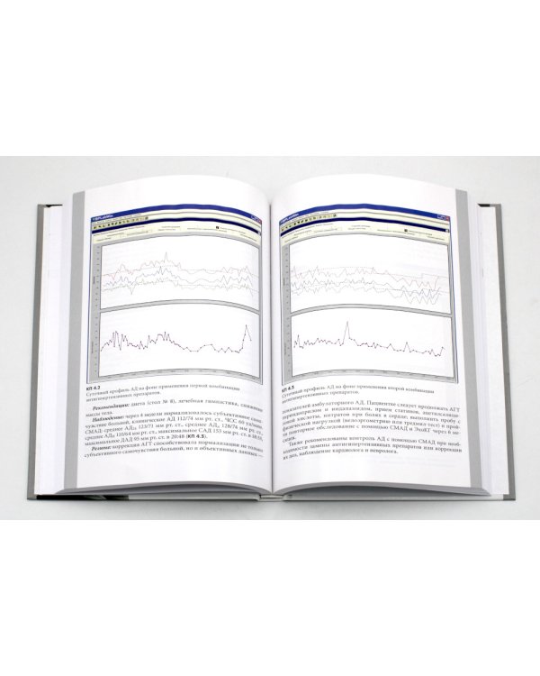 Суточное мониторирование артериального давления: современные аспекты