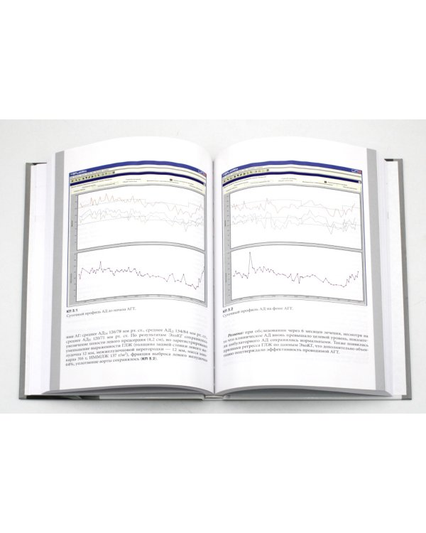 Суточное мониторирование артериального давления: современные аспекты