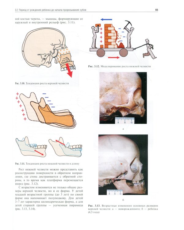 Ортодонтия. Диагностика и лечение зубочелюстно-лицевых аномалий и деформации: Учебник
