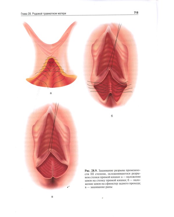 Акушерство. Руководство к практическим занятиям: Учебное пособие. 6-е изд., перераб.и доп
