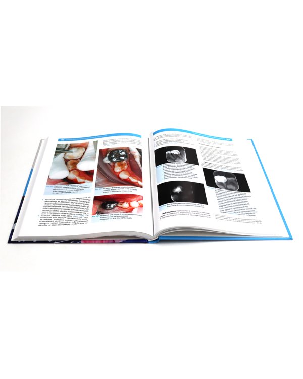 Детская стоматология. Лечение кариеса у детей раннего возраста (комплект из 2-х книг)