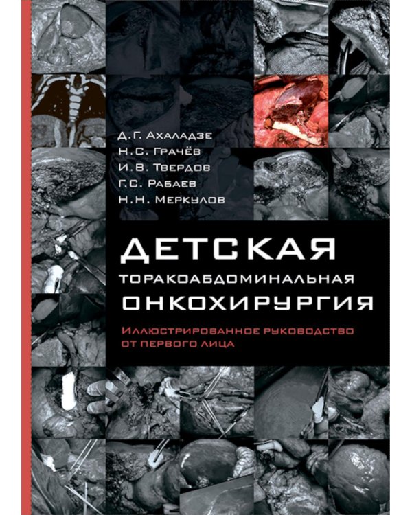 Детская торакоабдоминальная онкохирургия. Иллюстрированное руководство от первого лица