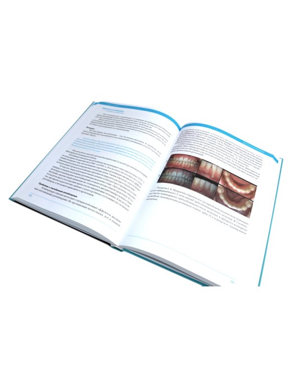 Дисфункции височно-нижнечелюстного сустава в ортодонтии. Доказательная ортодонтия. Статьи. (комплект из 2-х книг)